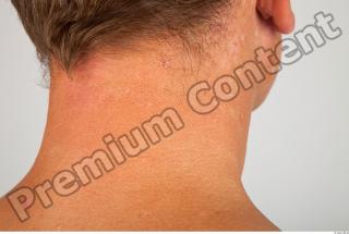 Neck 3D scan texture 0005